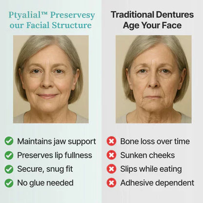 ✨Ends Today: 70% OFF! Ptyalial™⏰ Custom-Fit Full Functional Dentures Make you more confident